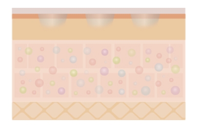 Infographic describing absorption of microneedle patches